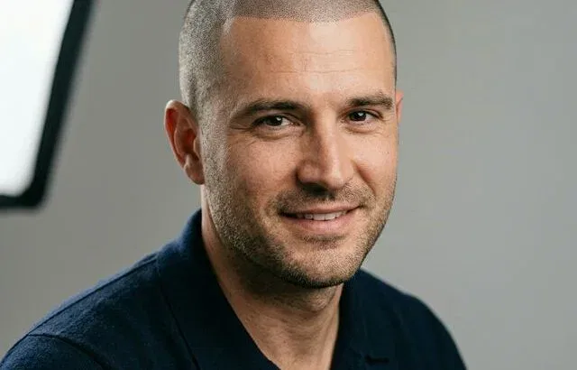 Scalp Micropigmentation Results