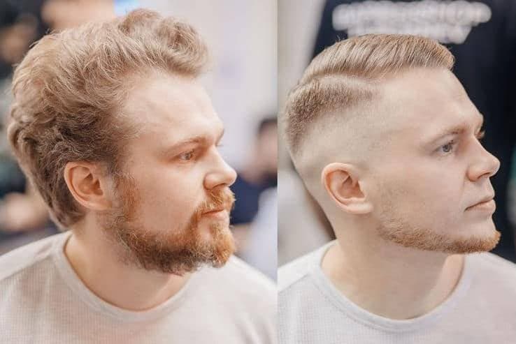 Buzz Haircut Fixes Receding Hairline See The Shocking Before After Results