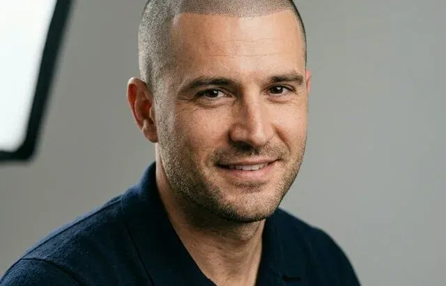 Scalp Micropigmentation (SMP): The Non-Surgical Hair Loss Solution