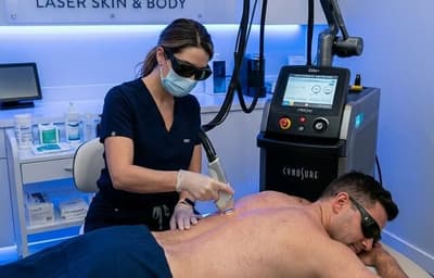 Laser hair removal for men